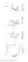 Fig. 17 - Apparatus and methods for nipple and breast formation