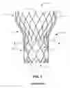 Fig. 02 - Bowed runners for paravalvular leak protection
