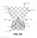 Fig. 04 - Bowed runners for paravalvular leak protection