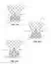Fig. 10 - Bowed runners for paravalvular leak protection
