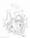 Fig. 02 - Mitral valve prosthesis
