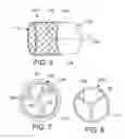 Fig. 04 - Mitral valve prosthesis