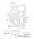 Fig. 09 - Mitral valve prosthesis