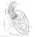 Fig. 01 - Systems for replacing a native heart valve and aorta with a prosthetic heart valve and conduit