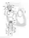 Fig. 01 - Apparatus and method for repairing the function of a diseased valve