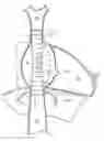 Fig. 01 - Heart valve prosthesis for percutaneous replacement of a tricuspid valve, and system comprising a heart valve prosthesis of said type