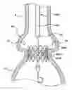 Fig. 01 - Delivery system having retractable wires as a coupling mechanism and a deployment mechanism for a self-expanding prosthesis