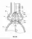 Fig. 13 - Delivery system having retractable wires as a coupling mechanism and a deployment mechanism for a self-expanding prosthesis