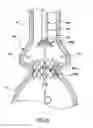 Fig. 14 - Delivery system having retractable wires as a coupling mechanism and a deployment mechanism for a self-expanding prosthesis