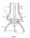 Fig. 22 - Delivery system having retractable wires as a coupling mechanism and a deployment mechanism for a self-expanding prosthesis