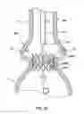 Fig. 24 - Delivery system having retractable wires as a coupling mechanism and a deployment mechanism for a self-expanding prosthesis