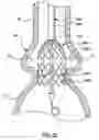 Fig. 13 - Delivery system having retractable wires as a coupling mechanism and a deployment mechanism for a self-expanding prosthesis