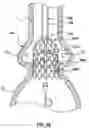 Fig. 20 - Delivery system having retractable wires as a coupling mechanism and a deployment mechanism for a self-expanding prosthesis
