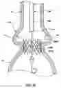 Fig. 24 - Delivery system having retractable wires as a coupling mechanism and a deployment mechanism for a self-expanding prosthesis