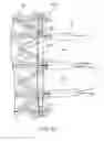Fig. 22 - Devices and methods for transcatheter valve loading and implantation
