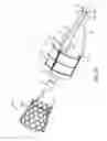 Fig. 29 - Devices and methods for transcatheter valve loading and implantation
