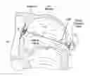Fig. 01 - Devices, systems, and methods for reshaping a heart valve annulus