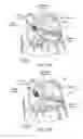 Fig. 07 - Devices, systems, and methods for reshaping a heart valve annulus