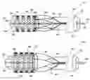 Fig. 01 - Percutaneous valve, system and method