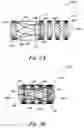 Fig. 02 - Percutaneous valve, system and method