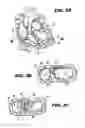 Fig. 03 - Method and device for percutaneous left ventricular reconstruction
