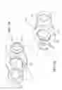 Fig. 10 - Internal joint stabilizer device, system and method of use