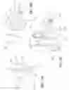 Fig. 11 - Internal joint stabilizer device, system and method of use