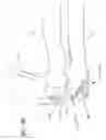 Fig. 19 - Internal joint stabilizer device, system and method of use