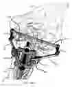 Fig. 22 - Internal joint stabilizer device, system and method of use