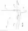 Fig. 23 - Internal joint stabilizer device, system and method of use