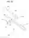 Fig. 27 - Internal joint stabilizer device, system and method of use