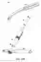 Fig. 17 - Devices and methods for creating wedge-shaped recesses
