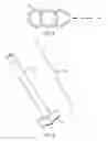 Fig. 04 - Partial joint resurfacing implant,instrumentation, and method