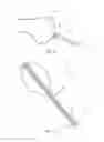 Fig. 06 - Partial joint resurfacing implant,instrumentation, and method