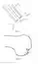 Fig. 07 - Partial joint resurfacing implant,instrumentation, and method