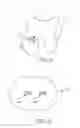 Fig. 09 - Partial joint resurfacing implant,instrumentation, and method