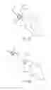 Fig. 14 - Partial joint resurfacing implant,instrumentation, and method