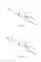 Fig. 15 - Partial joint resurfacing implant,instrumentation, and method