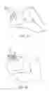 Fig. 18 - Partial joint resurfacing implant,instrumentation, and method