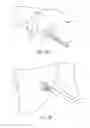 Fig. 21 - Partial joint resurfacing implant,instrumentation, and method