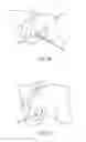 Fig. 26 - Partial joint resurfacing implant,instrumentation, and method
