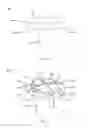 Fig. 38 - Partial joint resurfacing implant,instrumentation, and method