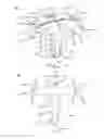 Fig. 43 - Partial joint resurfacing implant,instrumentation, and method
