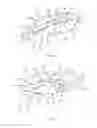 Fig. 45 - Partial joint resurfacing implant,instrumentation, and method