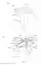Fig. 47 - Partial joint resurfacing implant,instrumentation, and method