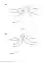 Fig. 48 - Partial joint resurfacing implant,instrumentation, and method
