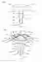 Fig. 50 - Partial joint resurfacing implant,instrumentation, and method