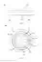 Fig. 53 - Partial joint resurfacing implant,instrumentation, and method