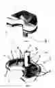 Fig. 02 - Prosthetic device for human body and production method therefor