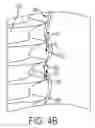 Fig. 18 - RETENTION DEVICES, LATTICES AND RELATED SYSTEMS AND METHODS
